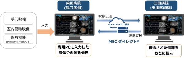 手術記録システム「OPeDrive」と「MECダイレクト(R)」を用いた遠隔手術支援および手術映像の教育活用の実証実験に成功