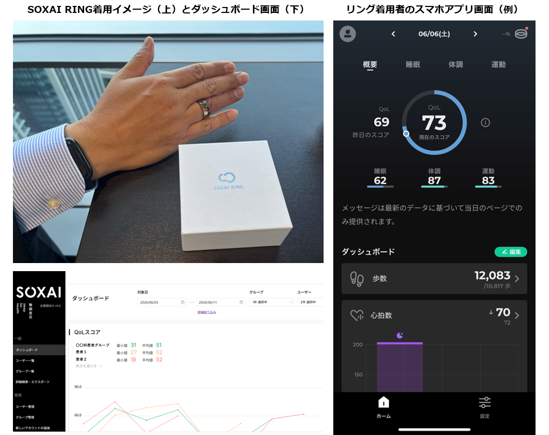 竹田健康財団とNTTドコモビジネス、スマートリングを活用した術後患者の経過観察に関する実証実験を開始