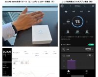 竹田健康財団とNTTドコモビジネス、スマートリングを活用した術後患者の経過観察に関する実証実験を開始